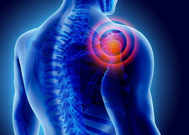 Rotator Cuff Tendonopathy — ACRO Physical Therapy & Fitness