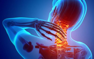 Case studdy Cervical pain in athletes