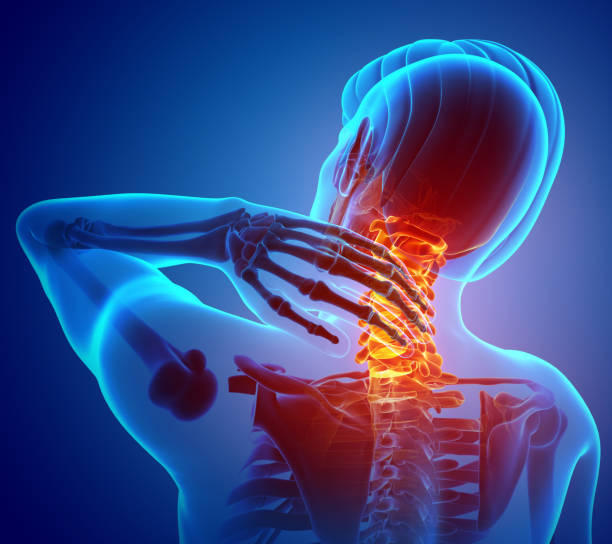 Case studdy Cervical pain in athletes